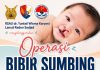 Operasi Bibir Sumbing Gratis di Natuna, RSAU dr. Yuniati Wisma Karyani Lanud RSA Buka Pendaftaran