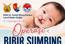 Operasi Bibir Sumbing Gratis di Natuna, RSAU dr. Yuniati Wisma Karyani Lanud RSA Buka Pendaftaran